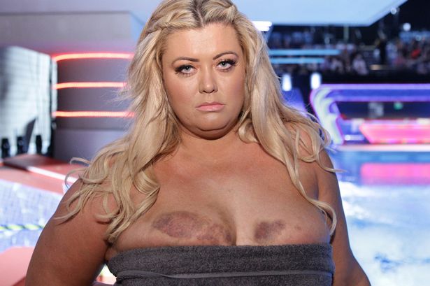 Gemma Collins