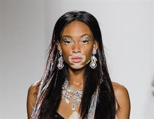 Winnie Harlow