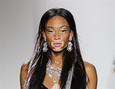 Winnie Harlow