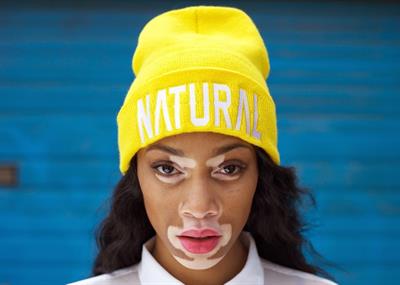 Winnie Harlow