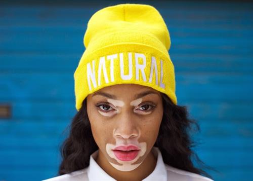 Winnie Harlow