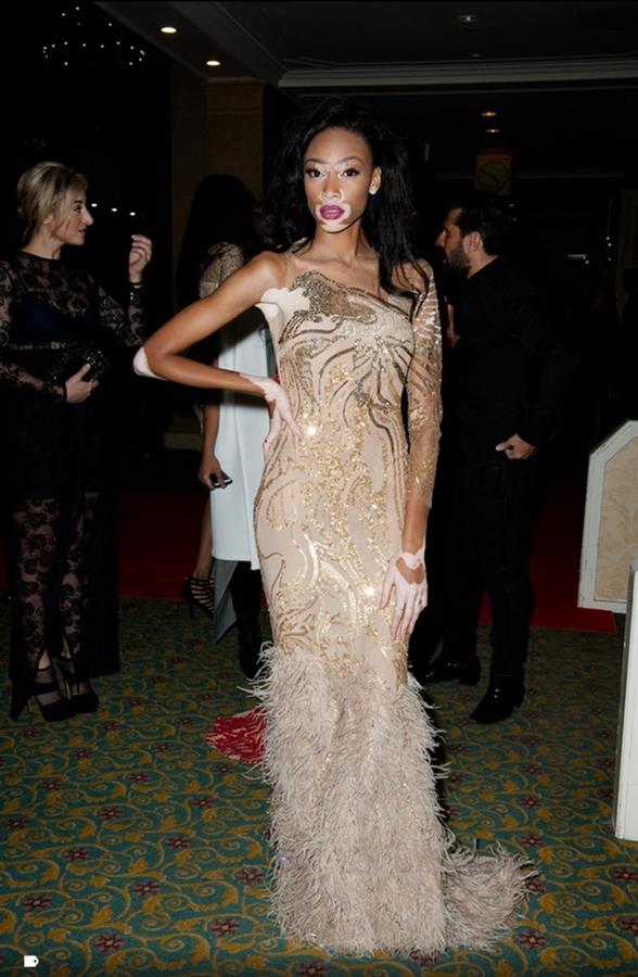 Winnie Harlow