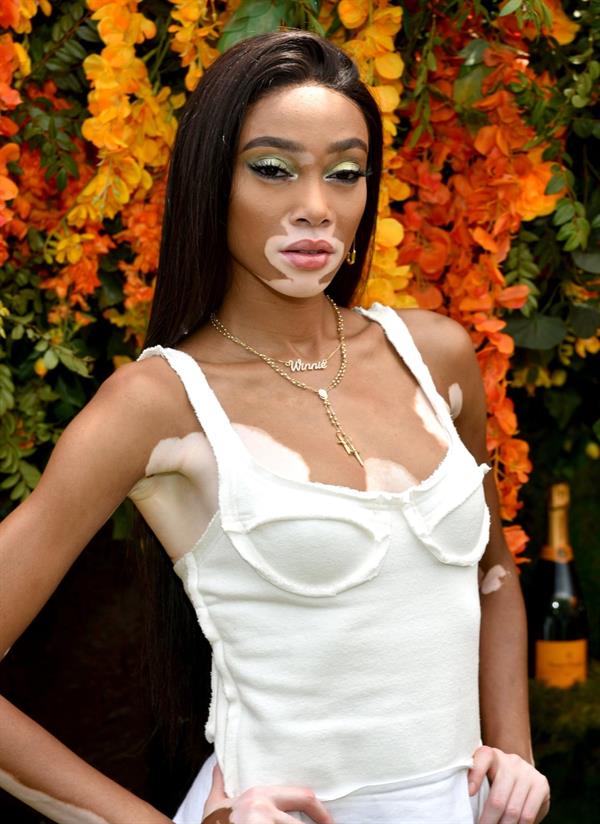 Winnie Harlow