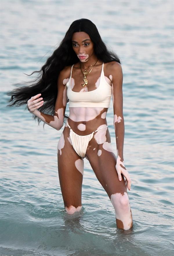 Winnie Harlow