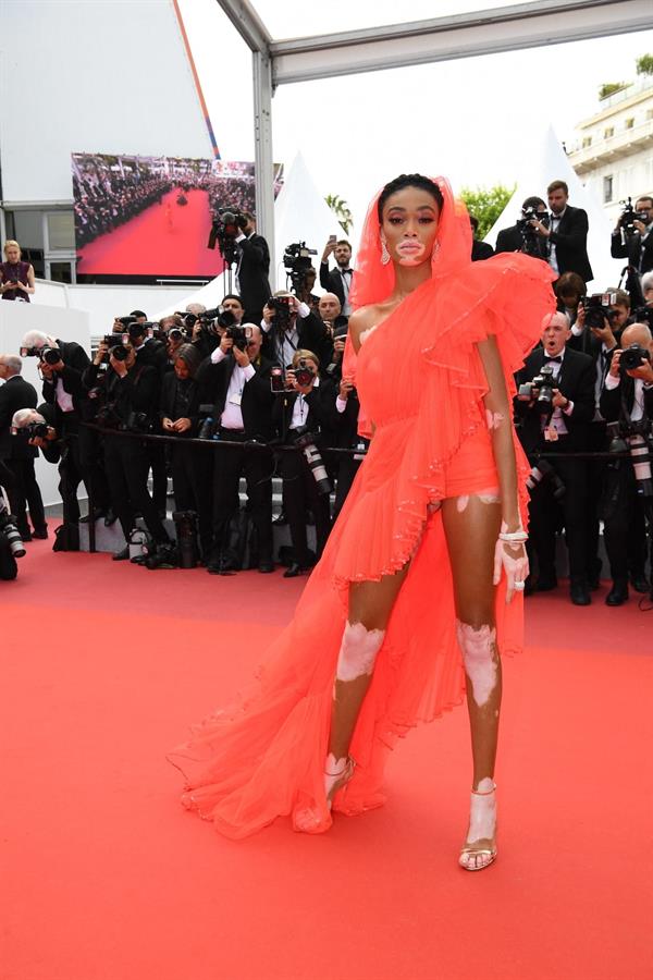 Winnie Harlow